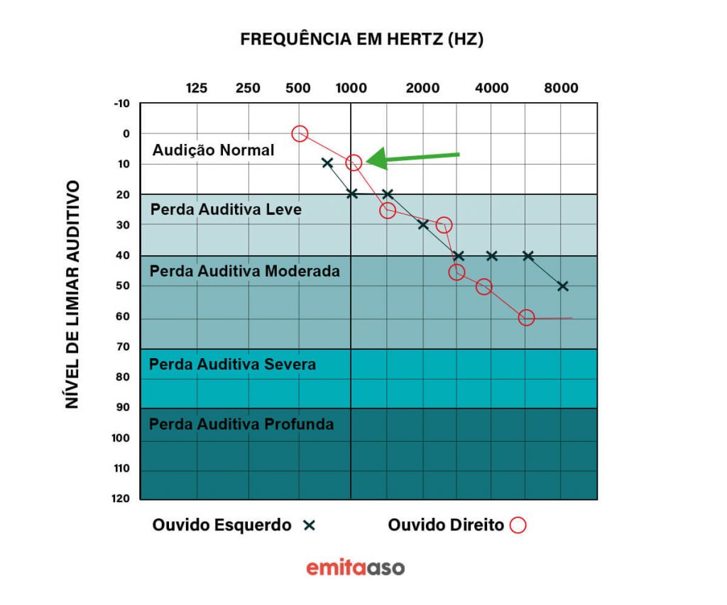 Audiometria - Frequência em hertz